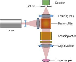 Figure 38.1, Schematic of the pathway of light in reflectance confocal microscopy: a point within the tissue is illuminated by a point source of laser light (830 nm laser). Light that is backscattered from tissue structures that are in the focal point is collected through a small aperture (pinhole) into the detector, while light out of focus is rejected. By scanning the focal point in the horizontal plane, an image is produced that represents a thin en face optical section of tissue.