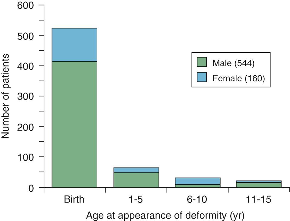 FIGURE 24-2, Age at appearance of pectus excavatum deformity in 704 infants and children. Note the large proportion identified at birth or within the first year of life and the predominance of males with this deformity.