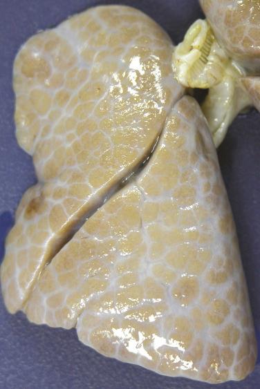 FIG. 4.1, Acinar dysgenesis. The lungs are small and show accentuated lobules with thickened interlobular septa.