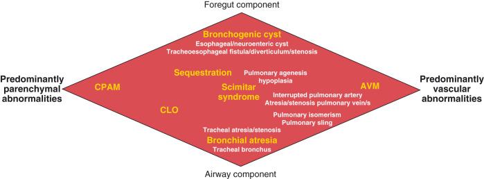 Figure 53.1, Diagram of the spectrum of congenital lung anomalies, including foregut and airway components.