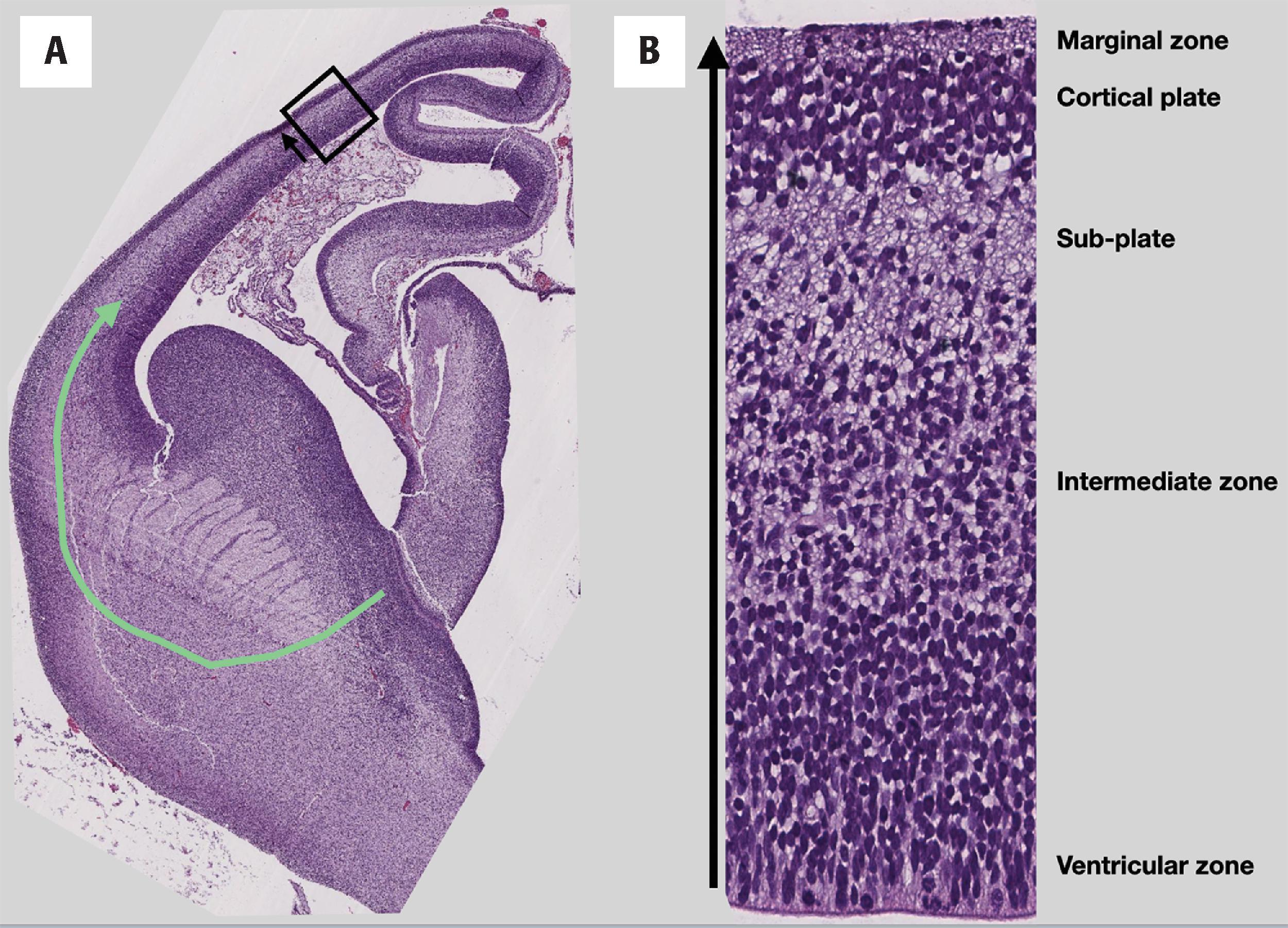 FIGURE 4.26, Cortical development. ( A ) Hematoxylin and eosin–stained axial section of an early-1st trimester human brain showing tangential migration pattern of GABAergic interneurons ( green arrow ) from the ganglionic eminences to the developing cortical plate. ( B) Boxed region magnified shows the radial migration pattern of glutamatergic excitatory neurons from the telencephalon ventricular zone to the cortical plate.