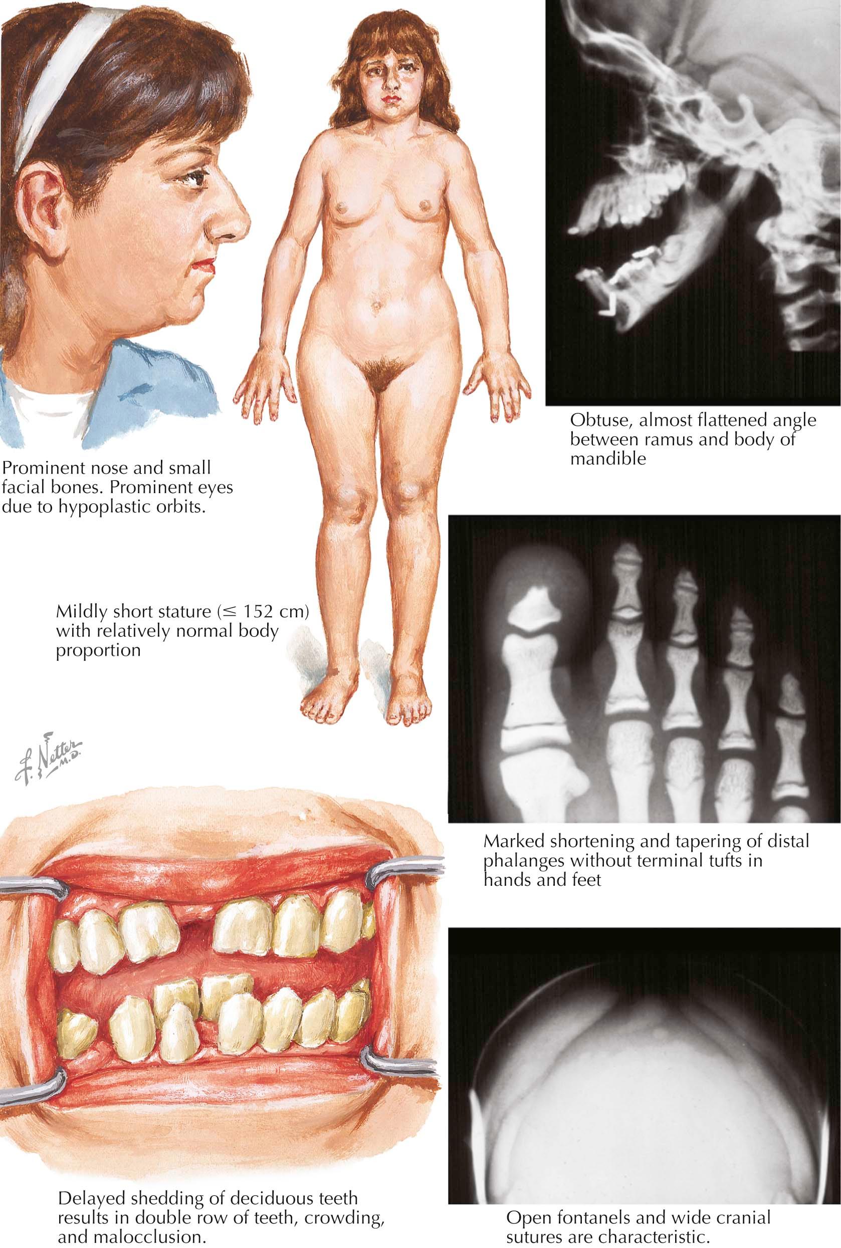 Plate 4-13