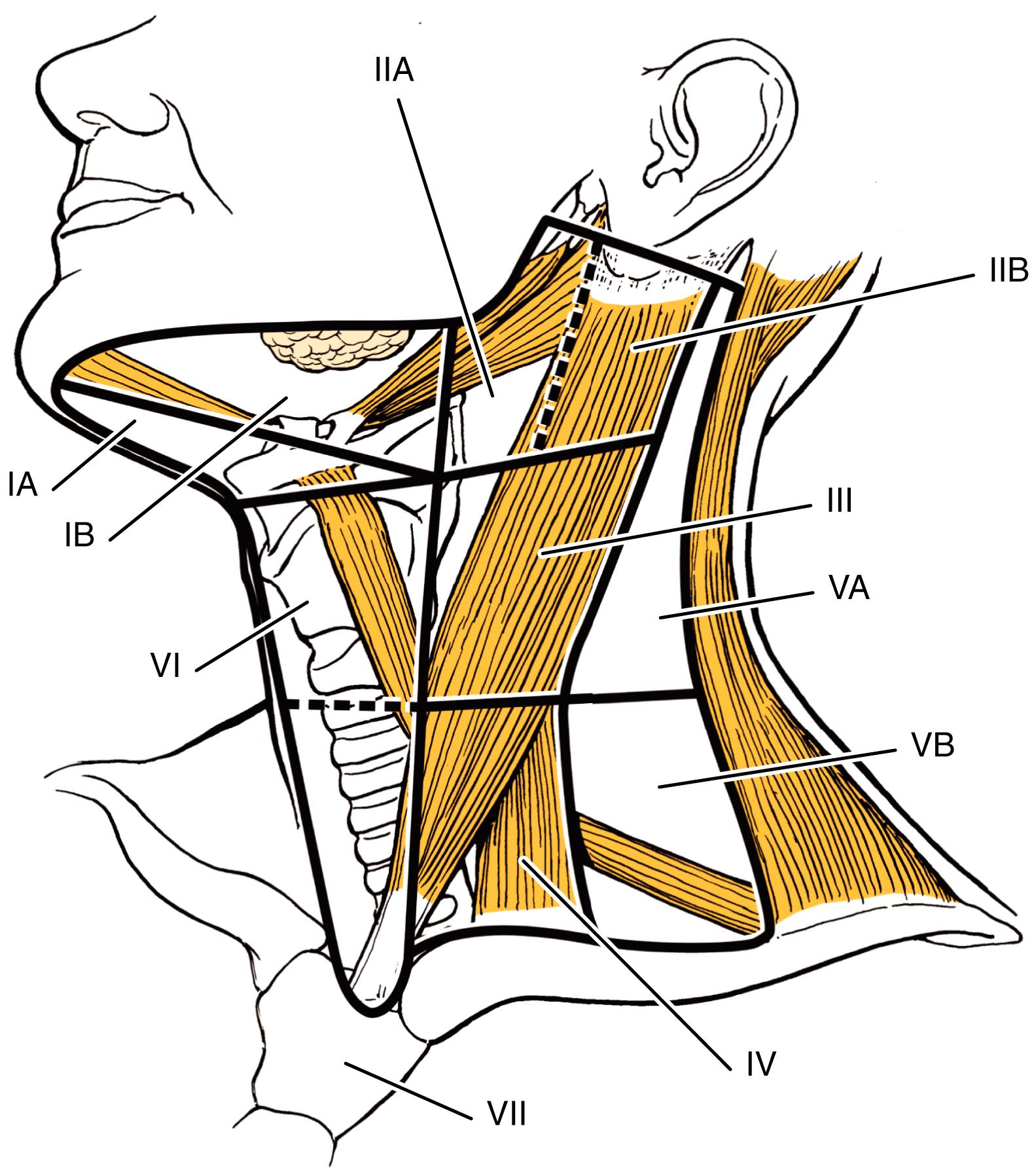 Fig. 23.2, Lymph node levels and boundaries of the neck.