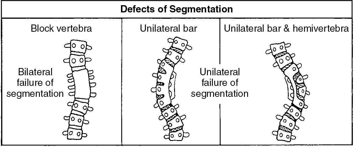 Fig. 39.1, Defects of segmentation.