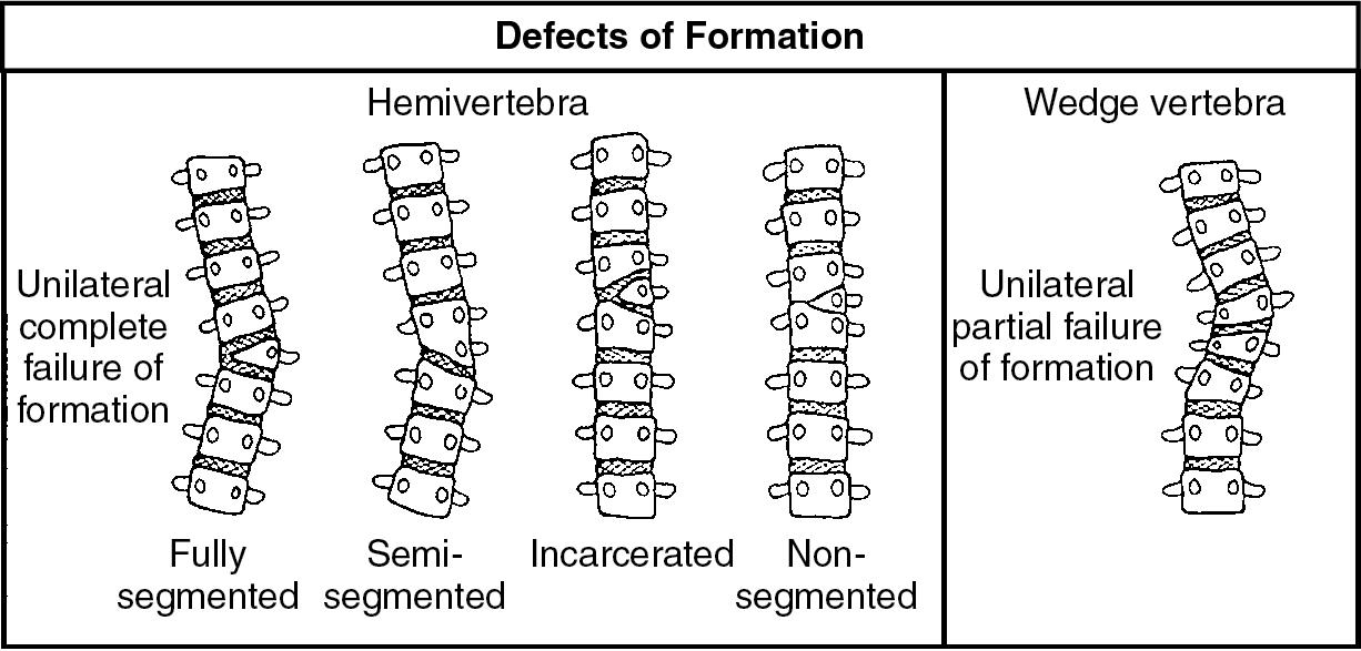 Fig. 39.2, Defects of formation.