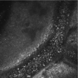 Fig. 13.4, Conjunctival blood vessel imaged using laser scanning confocal microscopy. The leucocytes can be imaged within the vessel. ‘Rolling’ versus ‘sticking’ leucocytes can be distinguished when these images are viewed as part of a movie sequence.