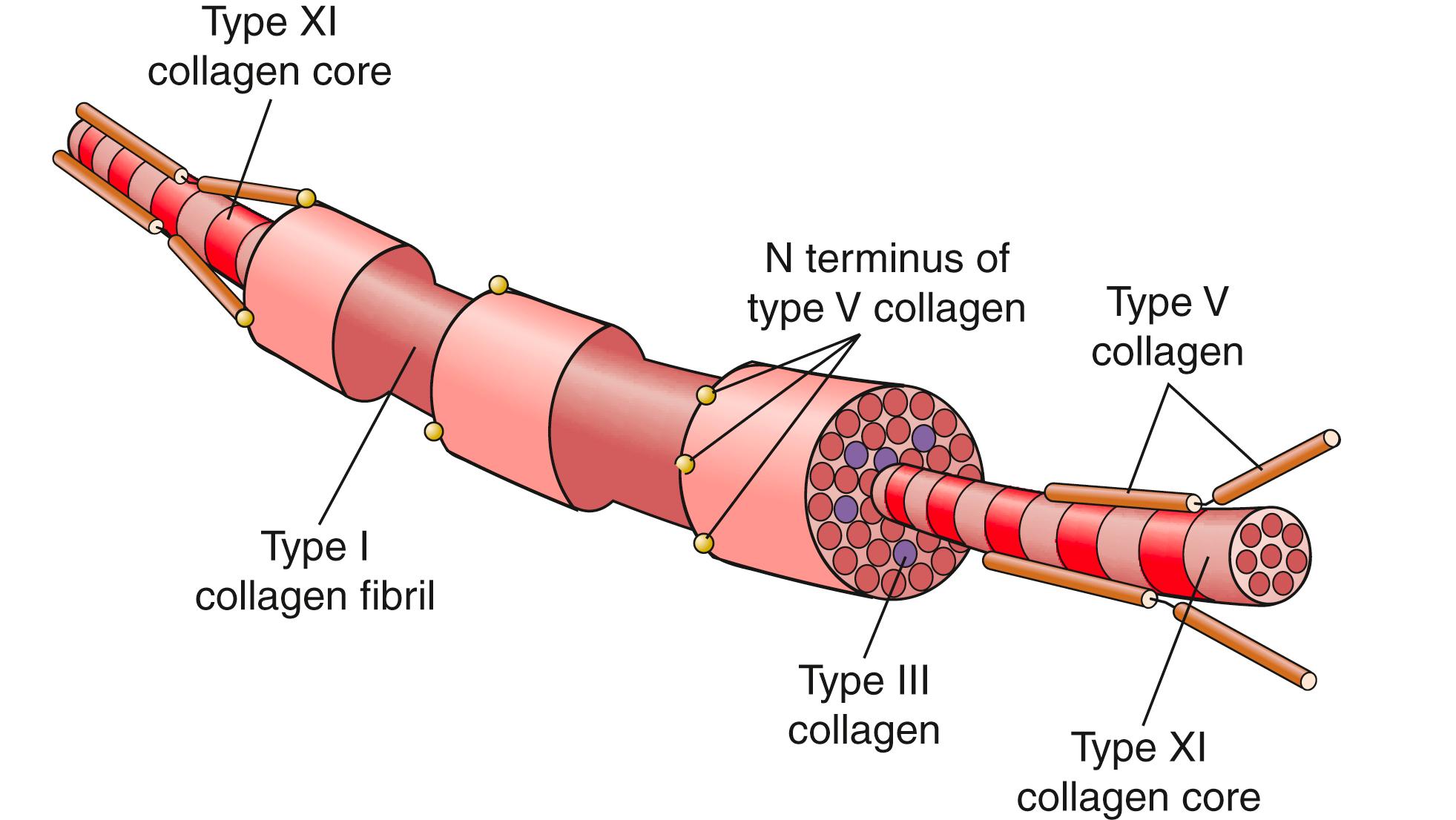 Fig. 6.6, Schematic diagram of type I collagen, demonstrating that it has a core of type XI and type V collagen. The bulk of type I collagen is interspersed with type II and type III collagen fibers.