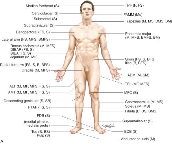 Figure 3.1, (A,B) Conventional and perforator-based workhorse flaps available in several regions of the body. Tissue types and some potential combinations that can be carried with the flaps are mentioned: B, bone; M, muscle; S, skin; F, fascia; Mu, mucosa. (C,D) Workhorse flaps commonly used for reconstruction of specific body regions. These are flaps customarily used for each body part, and include both free flap and pedicled flap alternatives. Although it may not be specifically listed, many workhorse flaps often have additional potential roles as a choice for other body regions. ADM, abductor digiti minimi; ALT, anterolateral thigh; AMT, anteromedial thigh; DIE(A)P, deep inferior epigastric (artery) perforator; DP, deltopectoral; EDB, extensor digiti brevis; FAMM, facial artery musculomucosal; FDB, flexor digitorum brevis; IGAP, inferior gluteal artery perforator; MFC, medial femoral condyle; PM, pectoralis major; PTAP, posterior tibial artery perforator; SEAP, superior epigastric artery perforator; SGAP, superior gluteal artery perforator; SIEA, superficial inferior epigastric artery; TDAP, thoracodorsal artery perforator; TPF, temporoparietal fascia; TFL, tensor fascia lata; TRAM, transverse rectus abdominis myocutaneous; VRAM, vertical rectus abdominis myocutaneous.