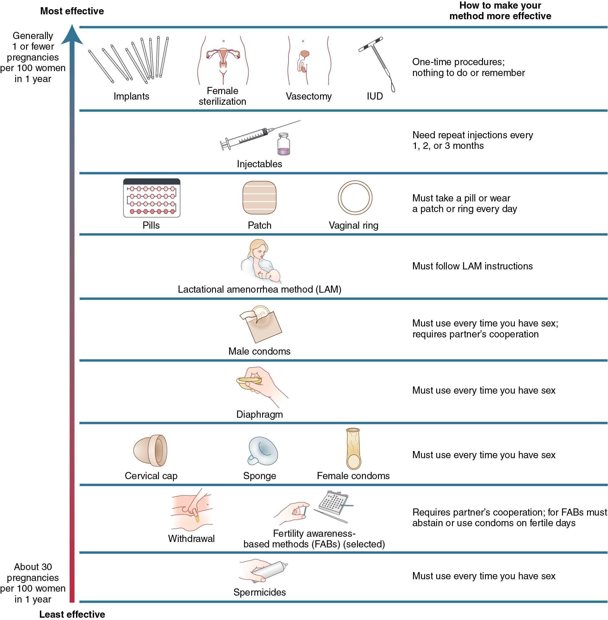 Fig. 13.1, The World Health Organization’s tiered approach contraception counseling tool comparing typical effectiveness of contraceptive methods. IUD, Intrauterine device.