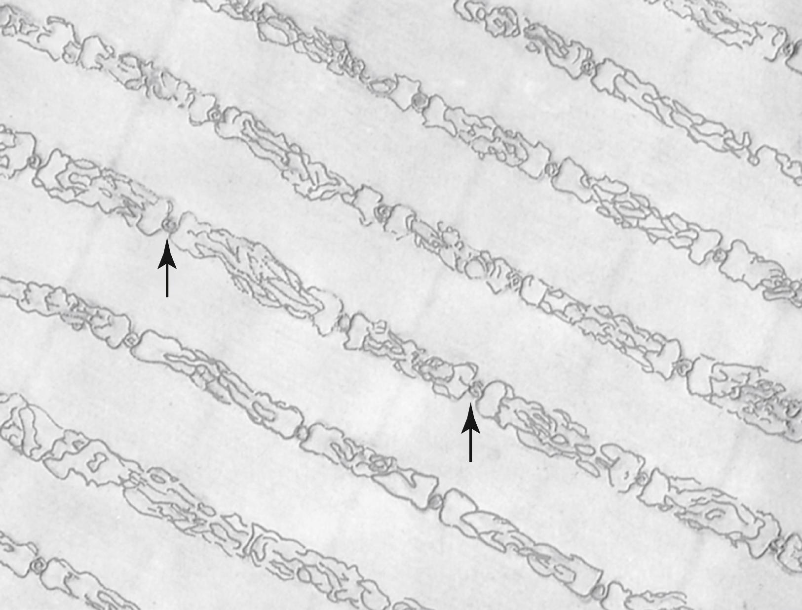 Figure 6-4, Sarcoplasmic reticulum in the spaces between the myofibrils, showing a longitudinal system paralleling the myofibrils. Also shown in cross section are T tubules ( arrows ) that lead to the exterior of the fiber membrane and are important for conducting the electrical signal into the center of the muscle fiber.