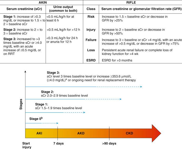 Fig. 6.1, Definition and classification of acute kidney injury (AKI) by AKIN, KDIGO, and ADQI. 3 4 5 50 Acute kidney disease (AKD) is defined as AKI stage 1 or greater that persists beyond 7 days after exposure. It may eventually result in chronic kidney disease, which is defined as abnormalities in kidney function that last greater than 90 days. The blue arrows reflect the risk to develop chronic kidney disease for each stage. a Assumes the baseline serum creatinine level is less than 353.6 μmol/L (<4.0 mg/dL), and that an episode of AKI has occurred. b Reflects that even when no apparent residual injury is present, the kidney might be vulnerable for some time after an episode of AKI. Stage 0 subtypes: C: SCr not back to baseline, B: Biomarker or loss of renal reserve indicates injury, A: No evidence of injury. AKD , Acute kidney disease; AKI , acute kidney injury; AKIN , acute kidney injury network; CKD , chronic kidney disease; ESRD , end-stage renal disease; RIFLE , risk, injury, failure, loss, and end-stage criteria; RRT , renal replacement therapy; sCr , serum creatinine.