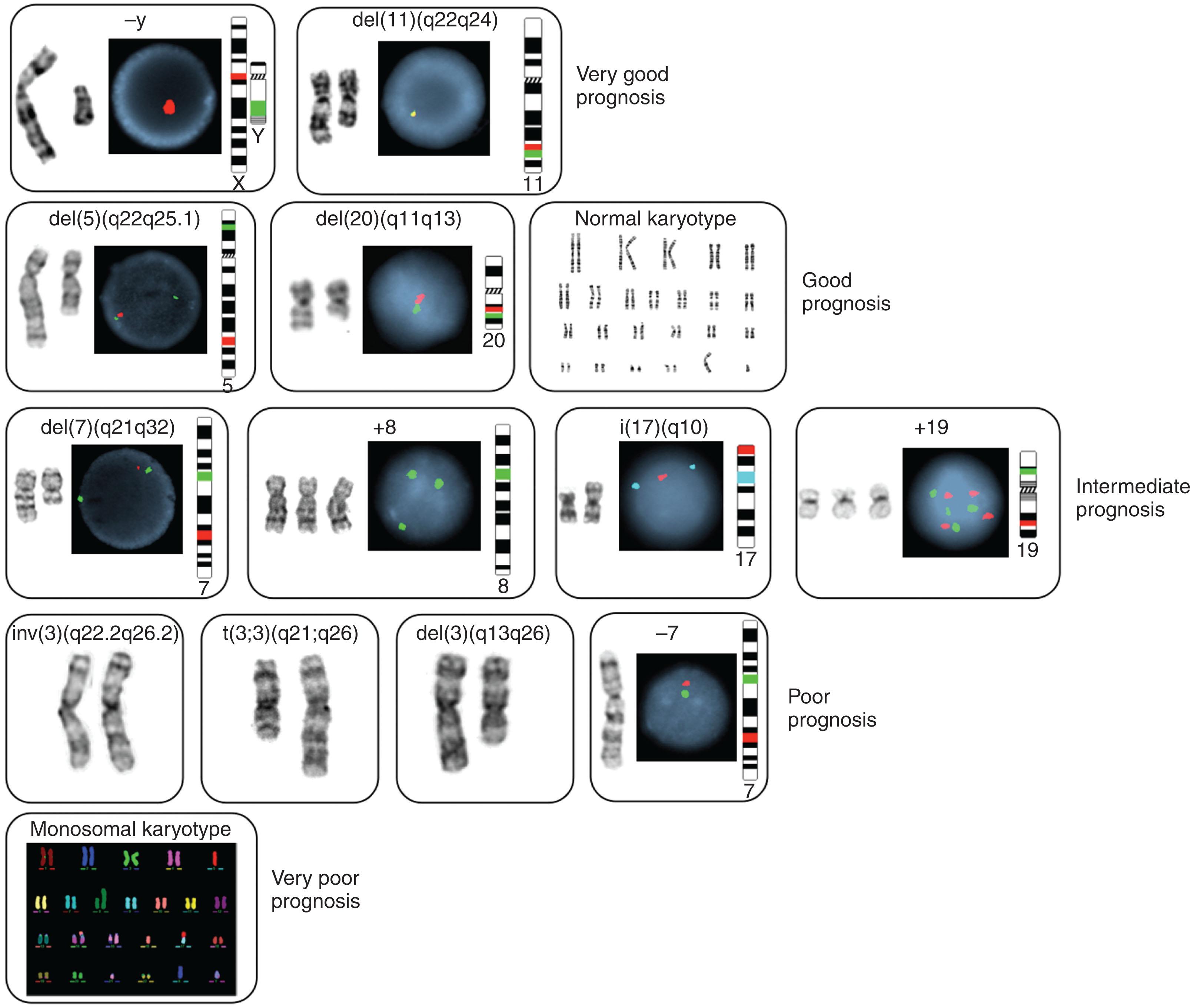 Figure 57.25, PROGNOSTIC SIGNIFICANCE OF THE RECURRENT CHROMOSOMAL ABNORMALITIES IN MYELODYSPLASTIC SYNDROME, ACCORDING TO THE NEW COMPREHENSIVE CYTOGENETIC SCORING SYSTEM.