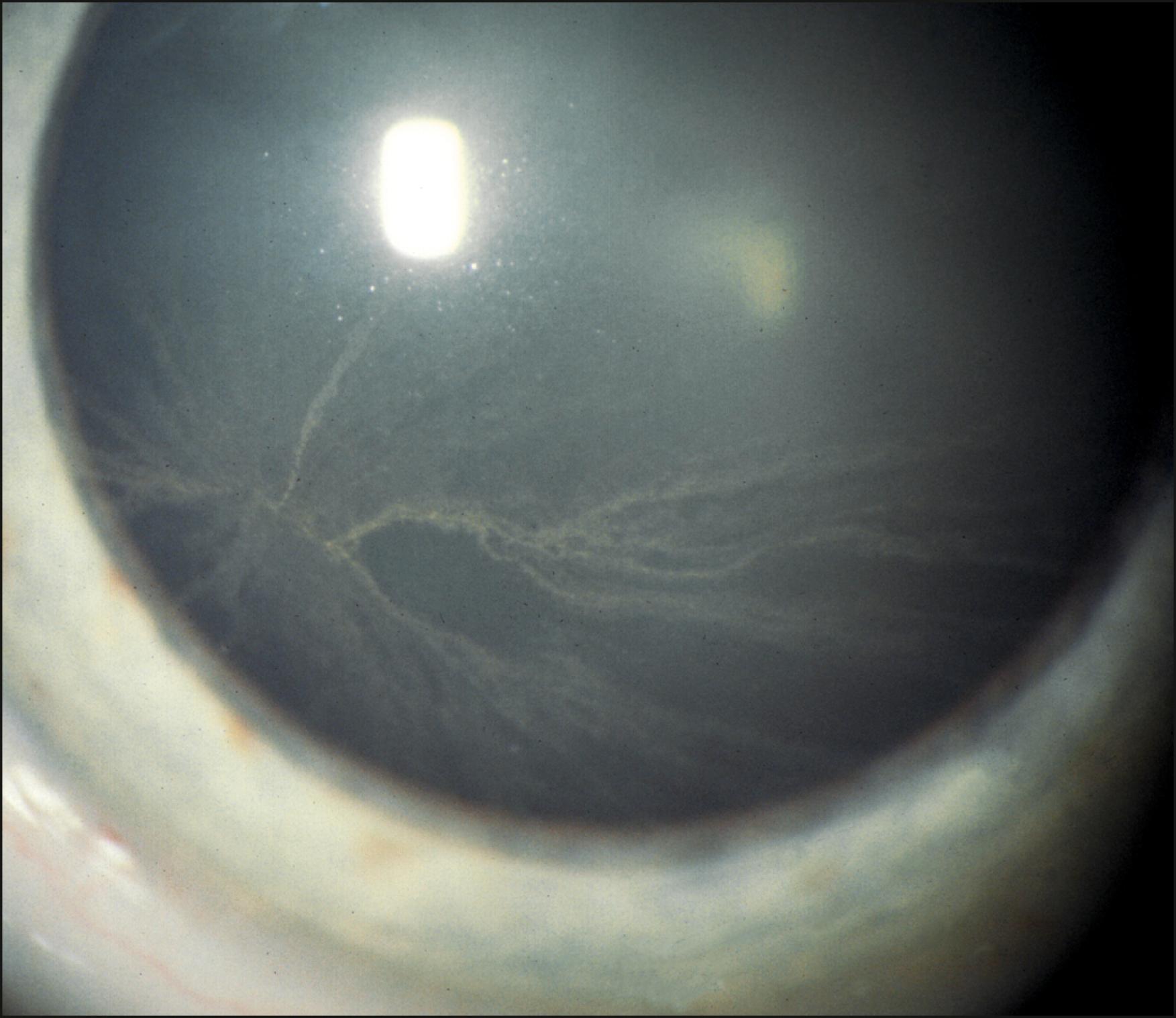 Fig. 22.1, Cornea verticillata.