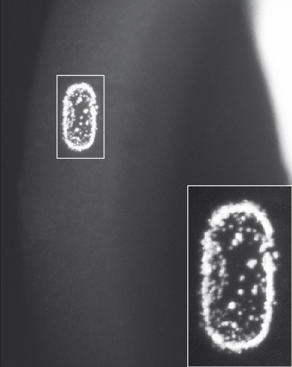 Fig. 22.7, Coat’s white ring.