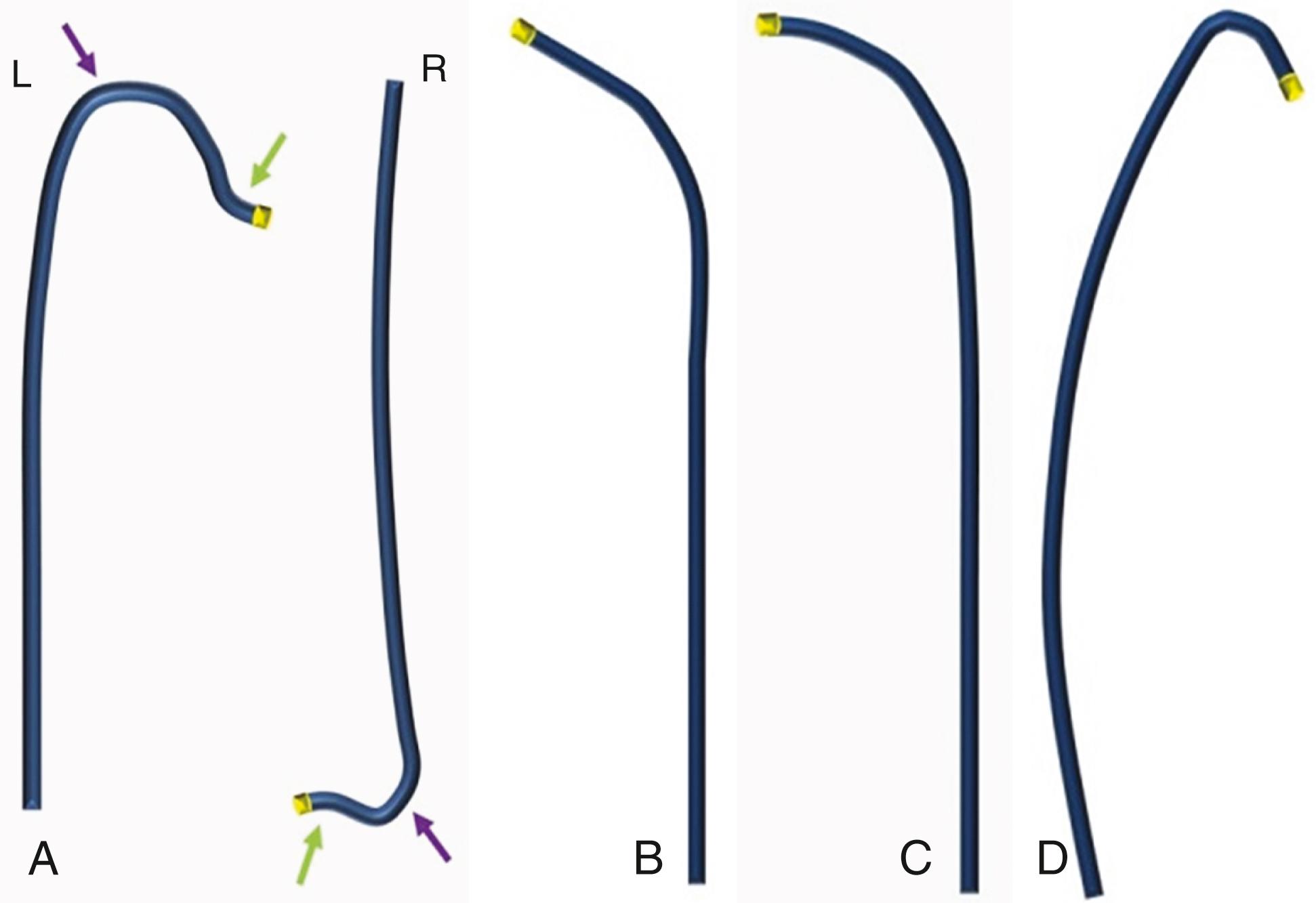 FIGURE 21.4, A, Amplatz catheters, left (L), for left coronary artery; right (R), for right coronary artery. Green arrows indicate the primary curve. Purple arrows show the secondary curve. B, Multipurpose A catheter. C, Multipurpose B catheter. D, Internal mammary artery catheter.