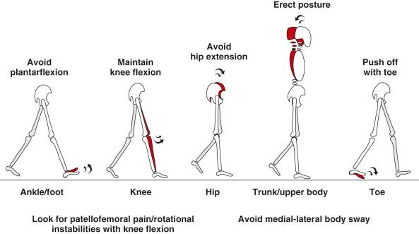 FIG 29-5, Gait abnormalities observed in patients before retraining. Shaded structures represent the correct, retrained positions at the trunk, upper body, hip, knee, foot, ankle, and toes.