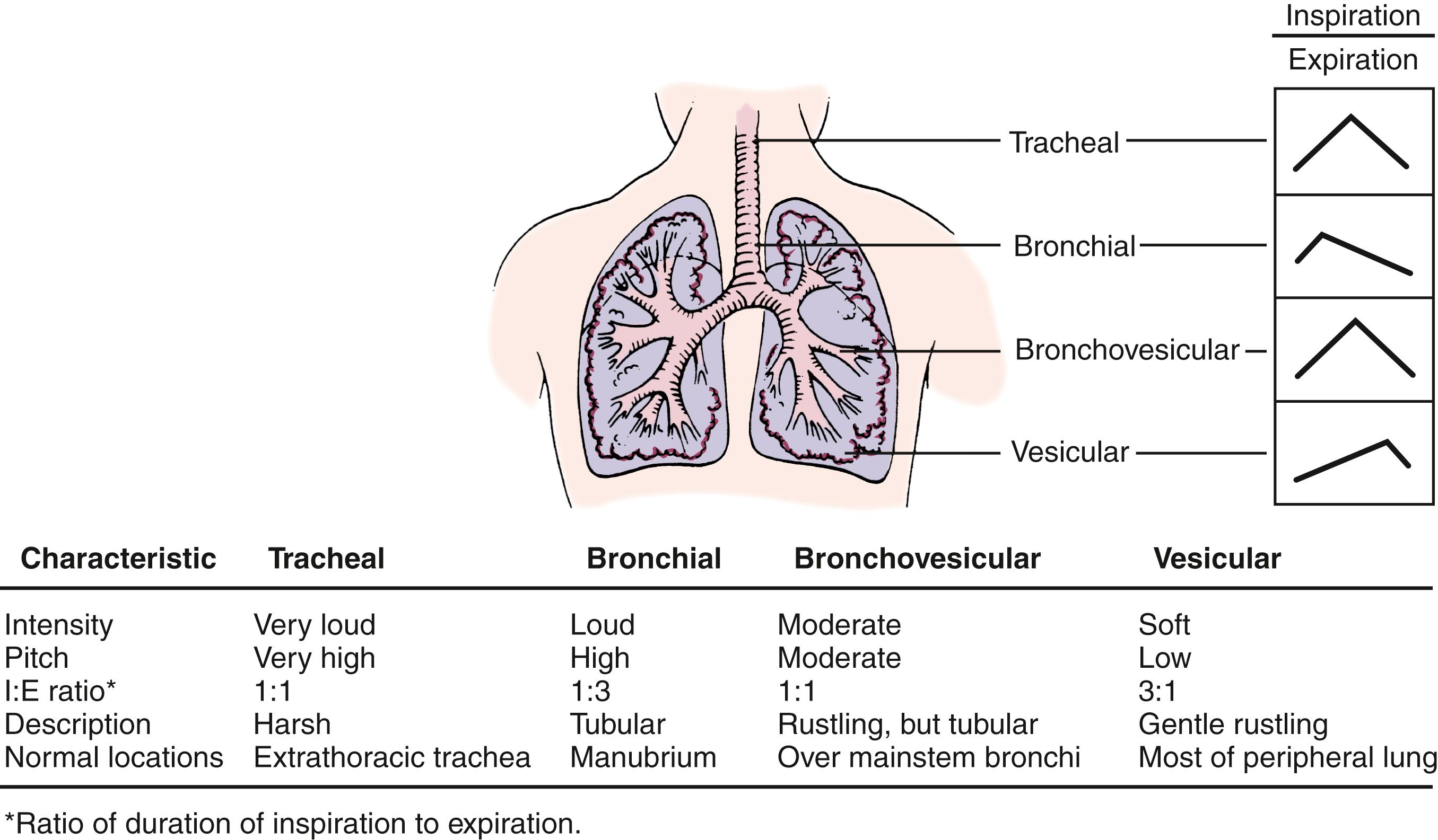 Fig. 3.6, Characteristics of breath sounds. Tracheal breath sounds are very harsh, loud, and high pitched; they are heard over the extrathoracic portion of the trachea. Bronchial breath sounds are loud and high pitched; normally, they are heard over the lower sternum and sound like air rushing through a tube. The expiratory component is louder and longer than the inspiratory component; a definite pause is heard between the two phases. Bronchovesicular breath sounds are a mixture of bronchial and vesicular sounds. The inspiratory (I) and expiratory (E) components are equal in length. They are usually heard only in the first and second interspaces anteriorly and between the scapulae posteriorly, near the carina and mainstem bronchi. Vesicular breath sounds are soft and low pitched; they are heard over most of the lung fields. The inspiratory component is much longer than the expiratory component; the latter is softer and often inaudible.