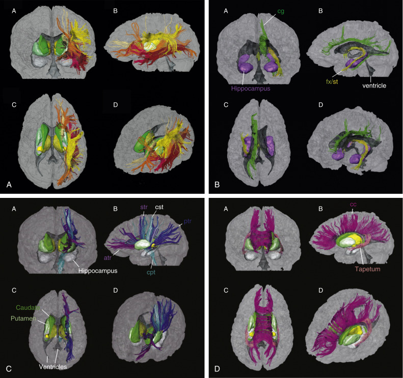 FIGURE 1-14, Diffusion tensor imaging (DTI) tractography. Using DTI data, discrete fiber tracts in the brain can be isolated and color coded for your visual pleasure, demonstrating association fibers (those axon bundles connecting different parts of the brain in the same cerebral hemisphere), projection fibers (those axons connecting the cortex with lower parts of the brain and spinal cord), and commissural fibers (those axons connecting between the two cerebral hemispheres). A, Three-dimensional reconstructions of association fibers are depicted, including in the anterior (A), left (B), superior (C), and oblique (left-anterosuperior) (D) orientations. Note the color coded projections of the superior longitudinal fasciculus (yellow), inferior fronto-orbital fasciculus (orange), uncinate fasciculus (red), and inferior longitudinal fasciculus (brown). Thalami are yellow, ventricles are gray, caudate nuclei are green and lentiform nuclei are light green. B, Three-dimensional reconstruction results of association fibers in the limbic system viewed from the anterior (A), left (B), superior (C), and oblique (left-anterior) (D) orientations. The hippocampi are depicted in purple. C, Three-dimensional reconstruction results of projection fibers viewed from the anterior (A), left (B), superior (C), and oblique (left-superior-anterior) (D) orientations. Depicted are anterior thalamic radiation (atr), corticopontine tract (cpt), corticospinal tract (cst), posterior thalamic radiation (ptr), and superior thalamic radiation (str). D, Three-dimensional reconstructions of commissural fibers viewed from the anterior (A), left (B), superior (C), and oblique (left-anterior-superior) (D) orientations. The corpus callosum (cc) is color coded magenta and the tapetum (commissural fibers extending to temporal lobes) is color coded peach. cg, Cingulum; fx, fornix; st, stria terminalis.