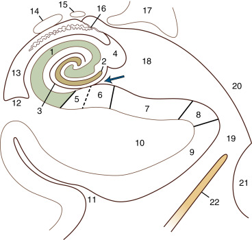 FIGURE 1-3, Hippocampal anatomy, coronal plane. Arrow indicates the hippocampal sulcus (superficial part). 1, cornu ammonis (Ammon’s horn); 2, gyrus dentatus; 3, hippocampal sulcus (deep or vestigial part); 4, fimbria; 5, prosubiculum; 6, subiculum proper; 7, presubiculum; 8, parasubiculum; 9, entorhinal area; 10, parahippocampal gyrus; 11, collateral sulcus; 12, collateral eminence; 13, temporal (inferior) horn of the lateral ventricle; 14, tail of the caudate nucleus; 15, stria terminalis; 16, choroid fissure and choroid plexuses; 17, lateral geniculate body; 18, lateral part of the transverse fissure (wing of ambient cistern); 19, ambient cistern; 20, mesencephalon; 21, pons; 22, tentorium cerebelli.