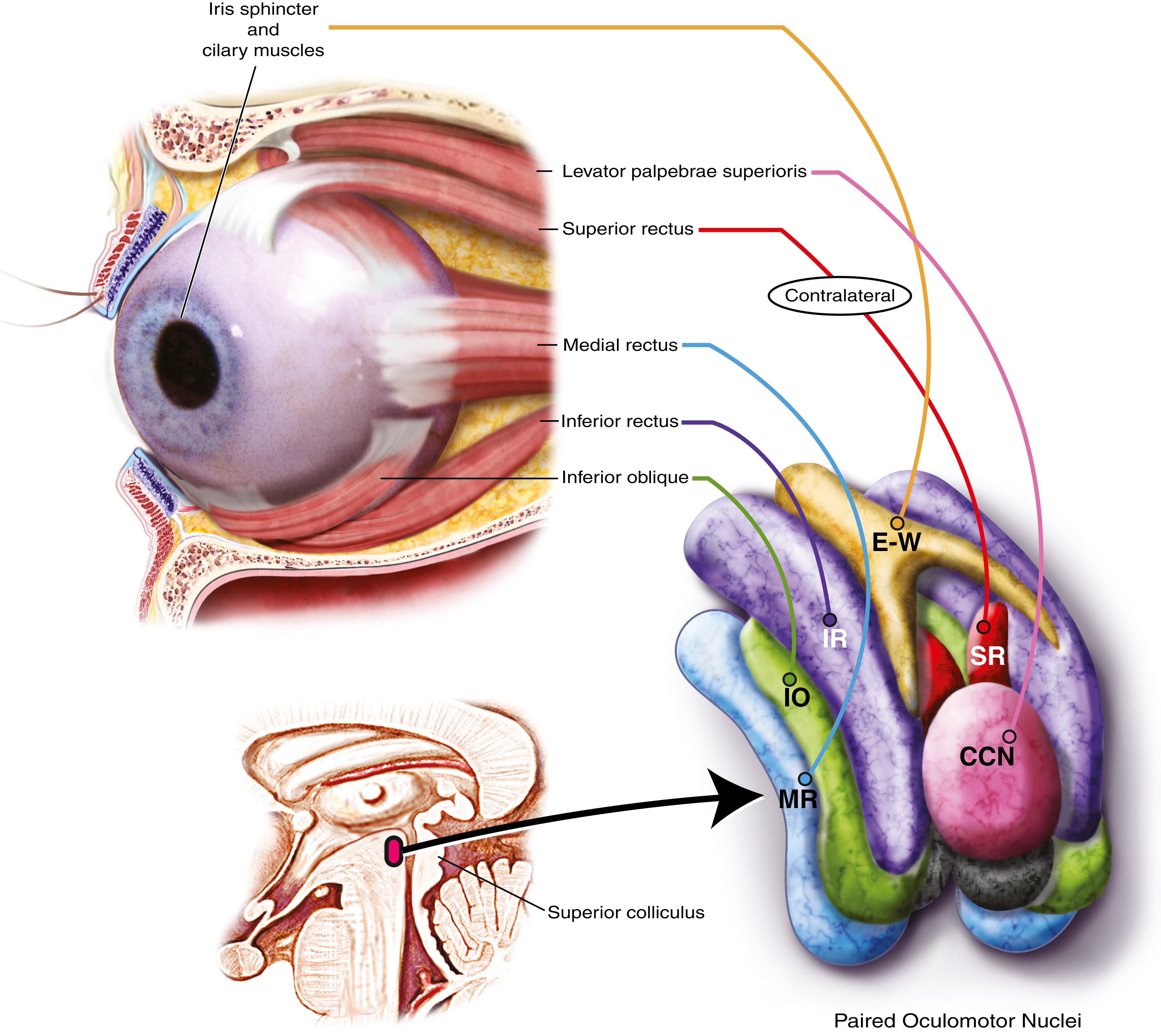 eFig. 103.1, Schematic of the paired oculomotor nuclei with a single midline shared central caudal nucleus (CCN) . Each nucleus is composed of a superior rectus subnucleus (SR) providing innervation to the contralateral superior rectus; inferior rectus (IR) , medial rectus (MR) , and inferior oblique subnuclei (IO) providing ipsilateral innervation. The single midline caudal central subnucleus (CCN) provides innervation to both levator palpebrae superioris muscles.