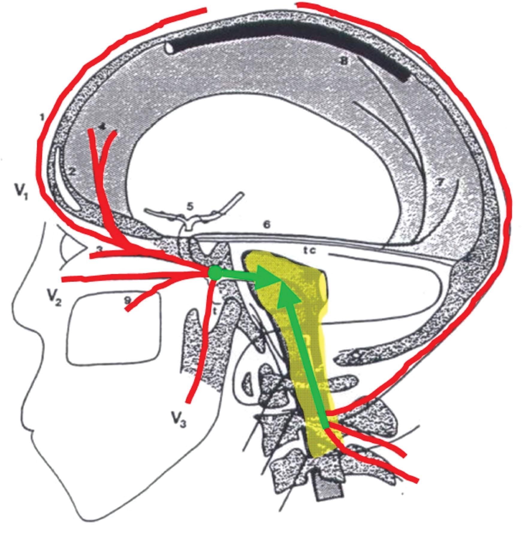 Figure 32.3, Cervicotrigeminal relay, showing the relationship between the trigeminal and occipital/upper cervical nerve roots.