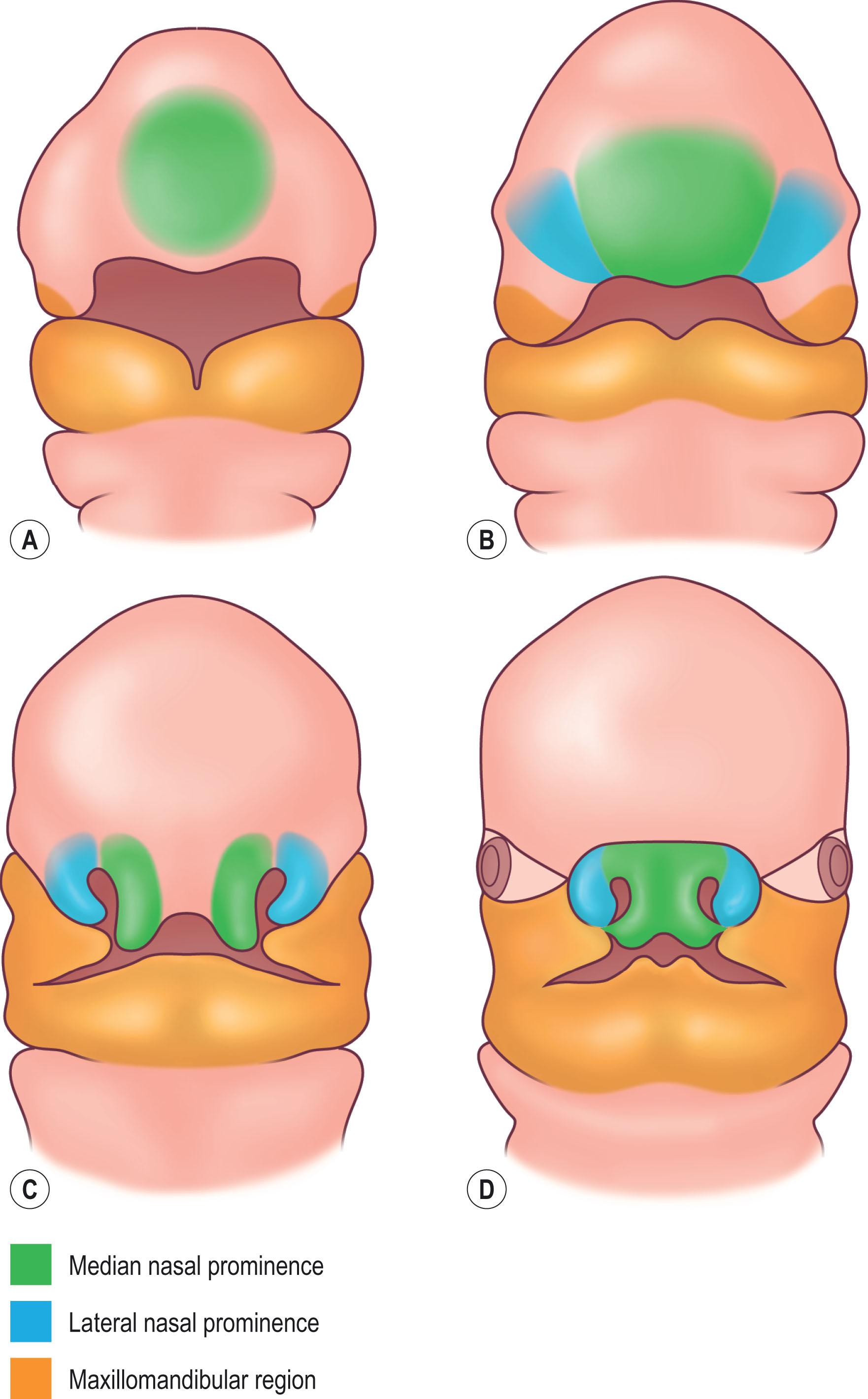 Figure 24.2, Embryology of the face. Illustration depicting facial development at: (A) 27 days; (B) 33 days; (C) 39 days; and (D) 46 days with migration of median nasal prominence, lateral nasal prominence, and maxillomandibular region.