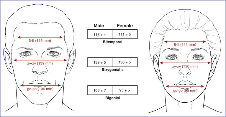 Fig. 5.1, Normal values in millimeters for upper, middle, and lower facial width in white North American adult men (ages 19 to 25) ( n = 109) and young white North American women ( n = 200). 1 Bitemporal distance (ft–ft) is measured from frontotemporal (ft) to frontotemporal, which is the point on each side of the forehead, laterally from the elevation of the linea temporalis. Bizygomatic distance (zy–zy) is measured from zygion (zy) to zygion, which is the most lateral point of each zygomatic arch. The bigonial distance (go–go) is measured from gonion (go) to gonion, which is the most lateral point of the mandibular angle close to the bony gonion. Because men’s heads and their features are, on the average, larger than women’s, this implies that the upper third of women’s faces are relatively wide. Note that the male lower face is both relatively and absolutely wider than that of the female.