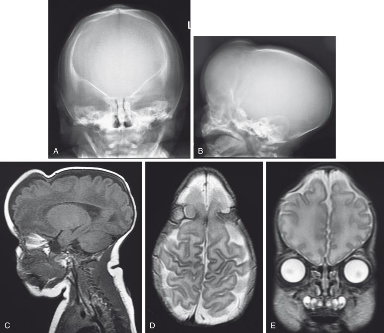 e-Figure 20.25, Multiple suture closure.