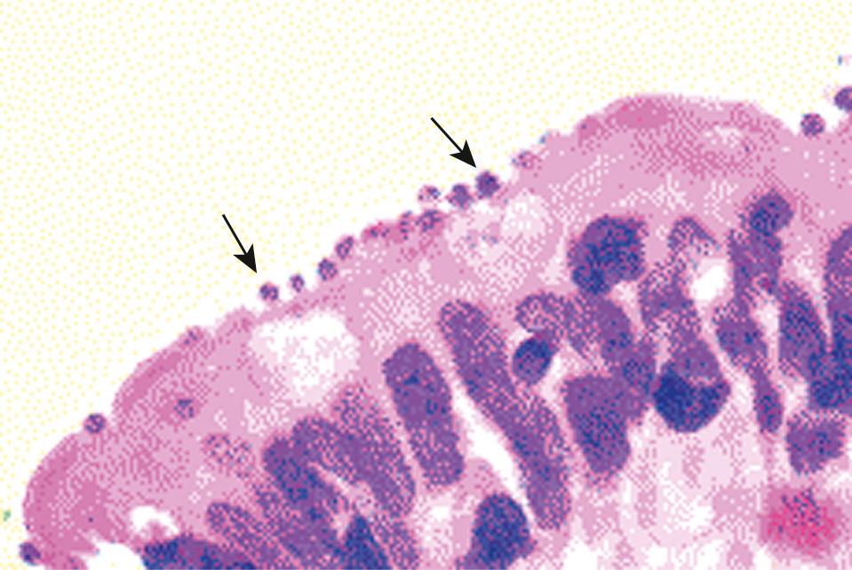 FIG. 282.2, Intestinal biopsy specimen showing Cryptosporidium intracellular forms (e.g., trophozoites and merozoites) (arrows) inside the surface of the intestinal epithelial cells.