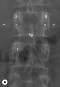 Fig. 47.2, Normal Imaging Anatomy of the Spine on Plain Film Radiography.