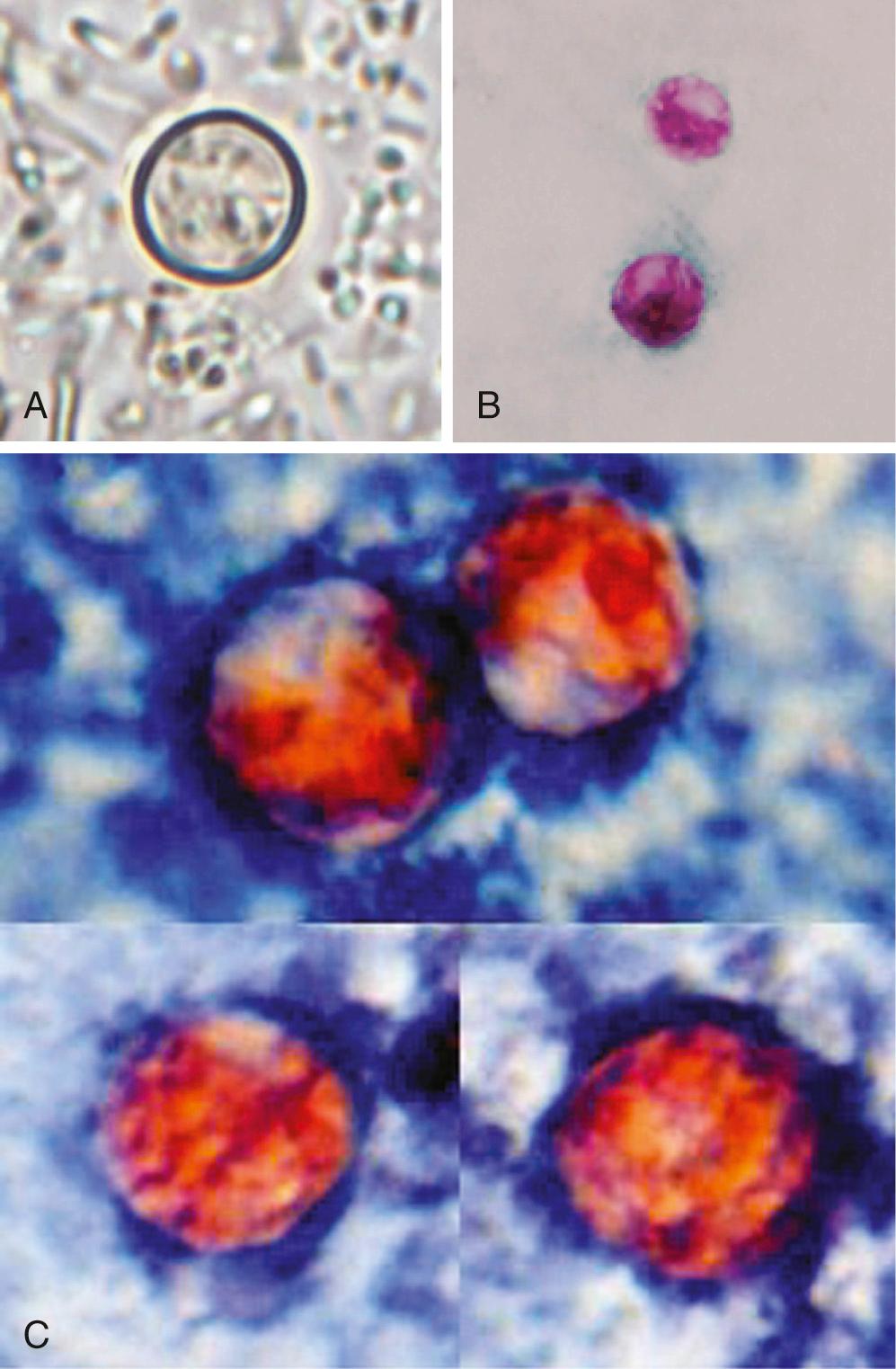 FIG. 283.1, Cyclospora oocysts visualized with different staining methods.