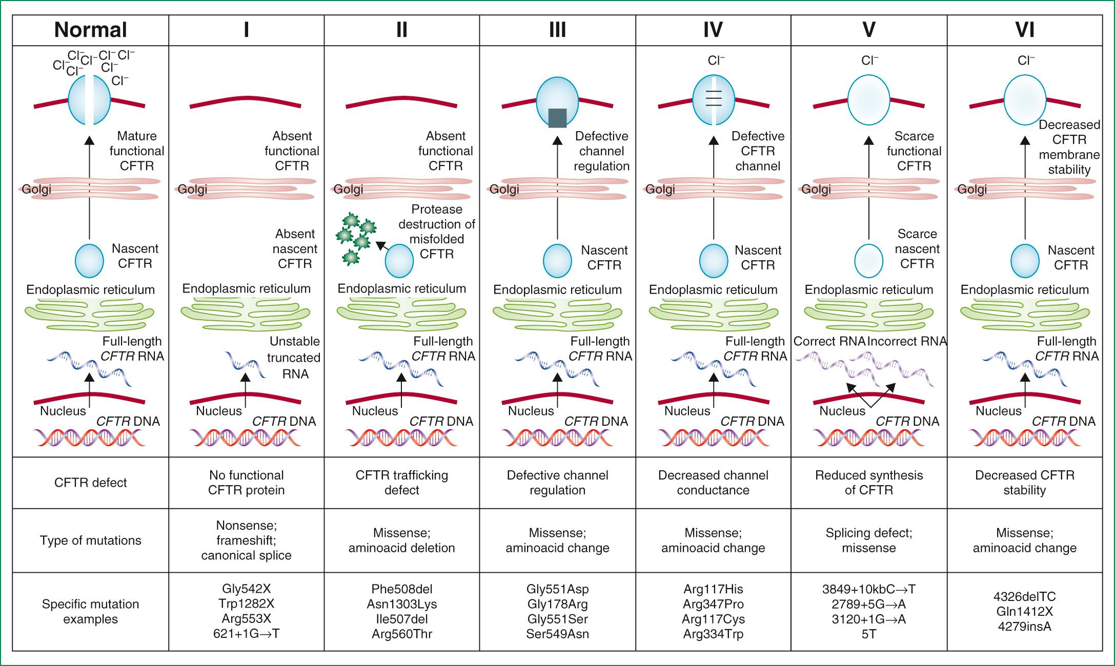 Fig. 432.2, Classes of cystic fibrosis transmembrane conductance regulator (CFTR) mutations. Mutations in the CFTR gene can be divided into 6 classes. Class I mutations result in no protein production. Class II mutations (including the most prevalent, Phe508del) cause retention of a misfolded protein at the endoplasmic reticulum and subsequent degradation in the proteasome. Class III mutations affect channel regulation, impairing channel opening (e.g., Gly551Asp). Class IV mutants show reduced conduction—that is, decreased flow of ions (e.g., Arg117His). Class V mutations cause substantial reduction in mRNA or protein, or both, Class VI mutations cause substantial plasma membrane instability and include Phe508del when rescued by most correctors (rPhe508del).