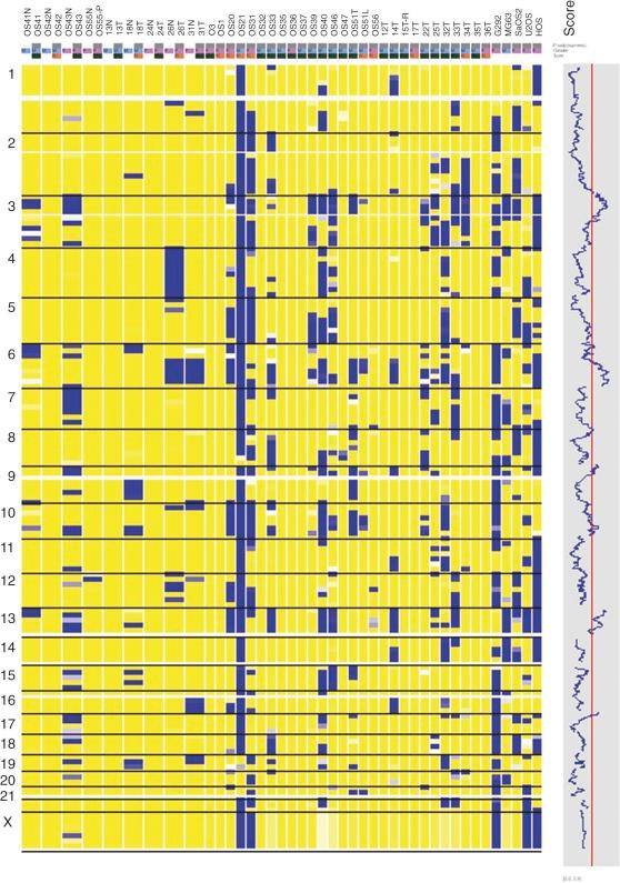 Figure 45-12, Genome-wide single-nucleotide polymorphism (SNP) analysis of osteosarcomas, with each column showing data from an individual case and the rows showing SNP data for each chromosome. Most osteosarcomas have numerous regions of SNP loss of heterozygosity, which are indicated in blue, whereas admixed regions of retained heterozygosity are in yellow.