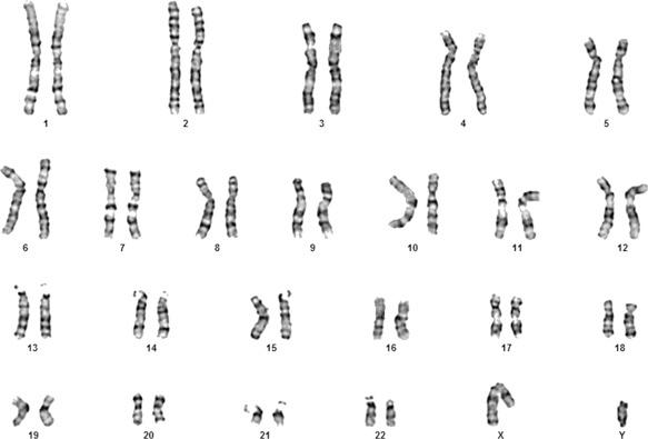 FIG. 4.1, Normal male G-banded karyotype.