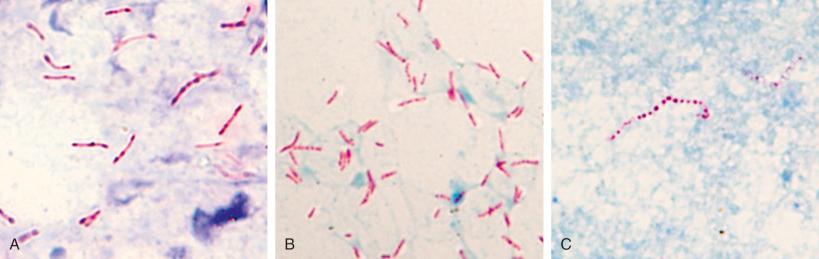 Figure 4.27, Mycobacteria are seen in Kinyoun stain from cytologic preparations. A, Mycobacterium tuberculosis complex. B, Mycobacterium avium complex. C, Mycobacterium kansasii (Kinyoun stain, ×1000).