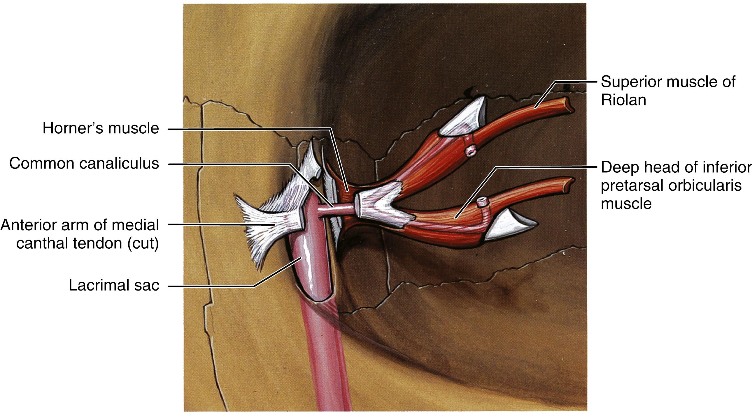 Fig. 149.1, Lacrimal drainage system, superficial anatomy.