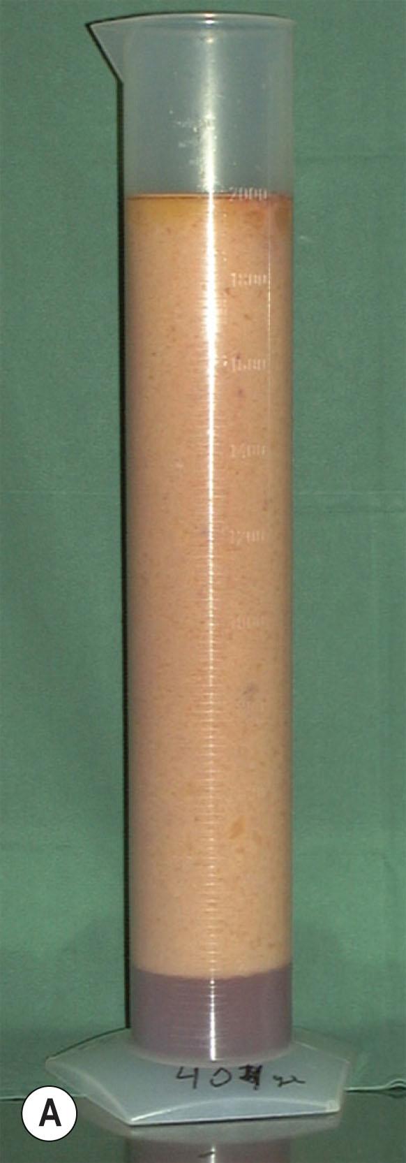 Figure 3.5.5, After 24 hours’ sedimentation, the aspirate contains (A) 90% to (B) 100% adipose tissue in general.