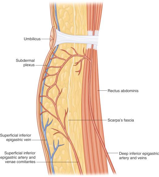 Figure 57.3, Paramedian sagittal view of the abdominal wall.