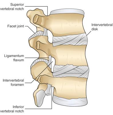 Figure 36.1, Three-joint complex. Each motion segment is composed of a three-joint complex, which consists of one intervertebral disk space and two dorsal zygapophyseal joints. Degeneration in one of these joints often leads to accelerated degeneration in the adjacent joints. This results in a relatively predictable progression of degeneration.