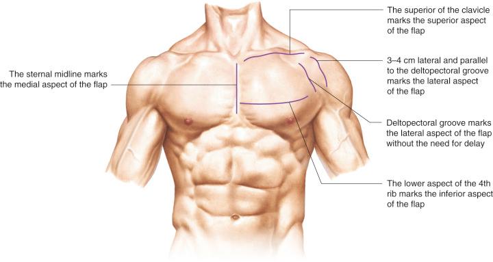 Figure 35.1, Anatomic landmarks.