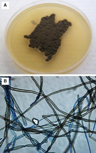 Figure 25-1, A, Pigmented colony typical of dematiaceous fungi after 5 days of growth on inhibitory mold agar (IMA). This organism was identified as Cladosporium spp. B, Sterile brown hyphae of a dematiaceous fungus.