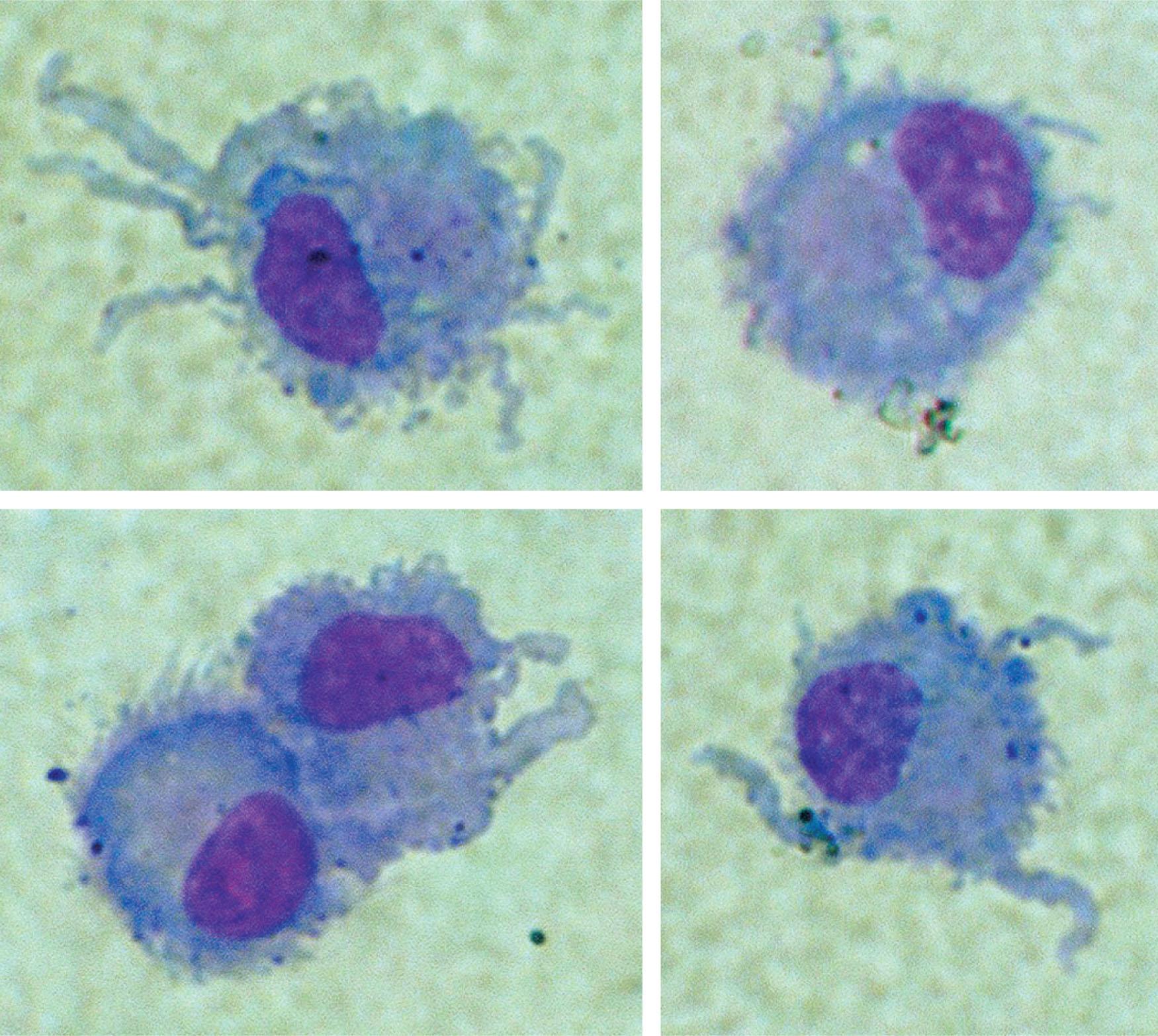 Figure 20.2, EXAMPLES OF MONOCYTE-DERIVED MATURE DENDRITIC CELLS.