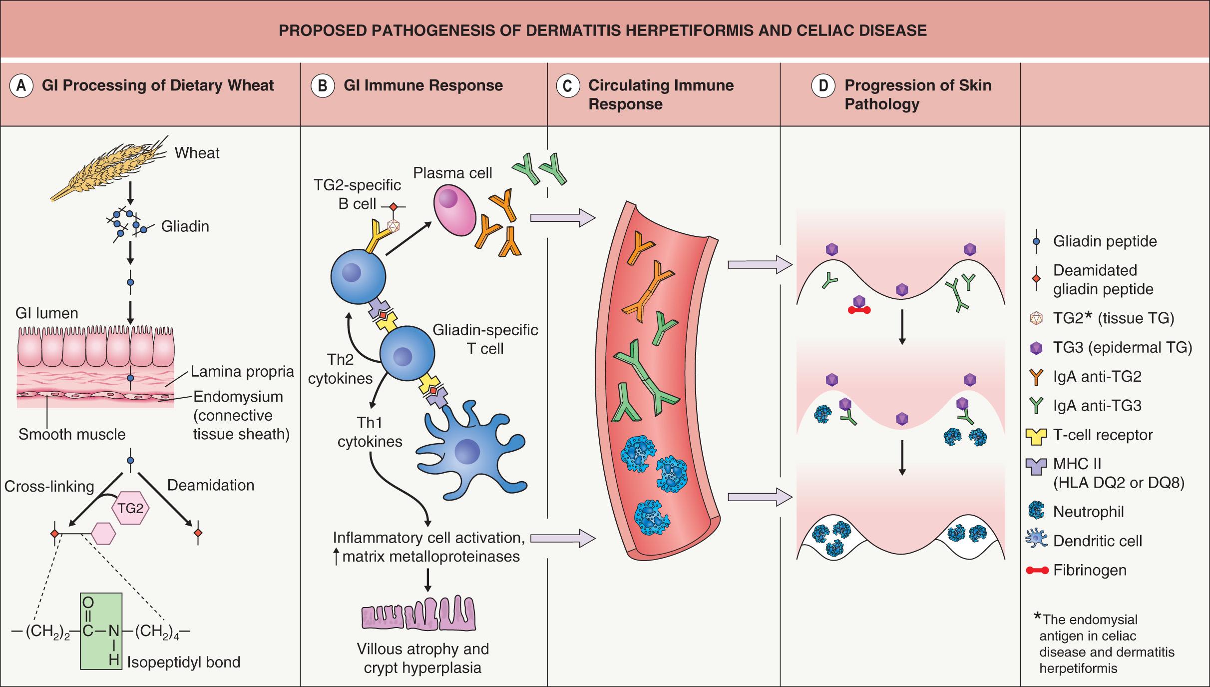 Fig. 31.1, Proposed pathogenesis of dermatitis herpetiformis and celiac disease.