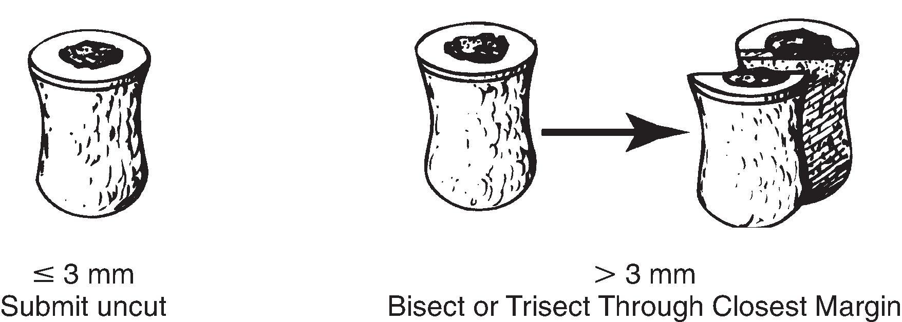 Figure 15.1, Skin punch biopsies.