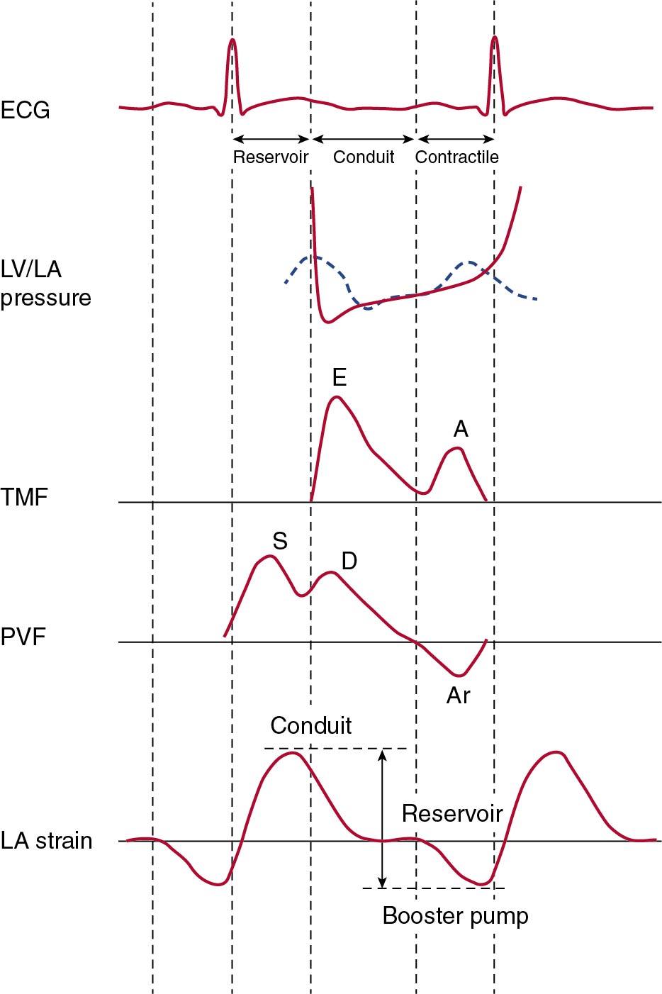 Fig. 6.7, Diagram of the phasic analysis of left atrial (LA) function. Simultaneous LA strain, mitral Doppler, pulmonary vein Doppler, electrocardiographic, and LA and left ventricular (LV) pressure tracings are shown.