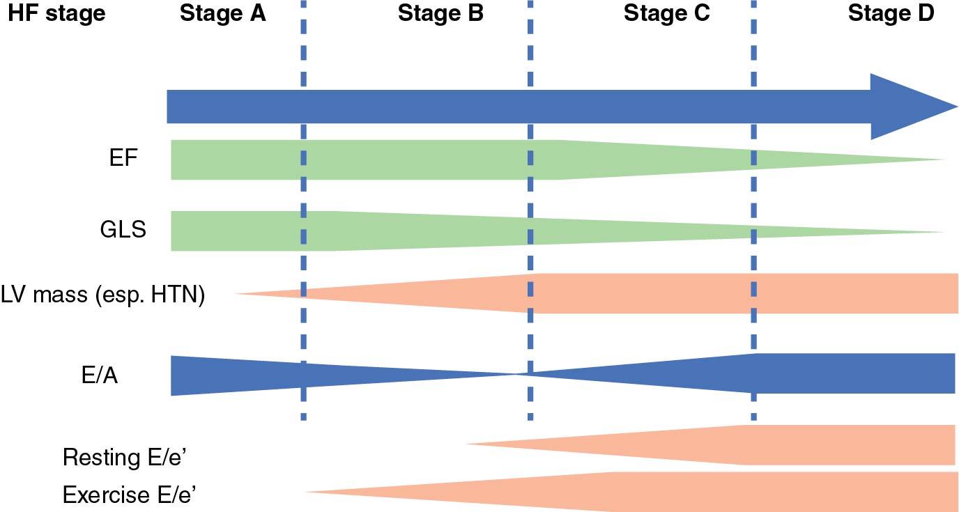 Central illustration, Changes in various echocardiographic functional parameters and their relation to stage of heart failure EF = ejection fraction, GLS = global longitudinal strain, HTN = hypertension, LV = left ventricular