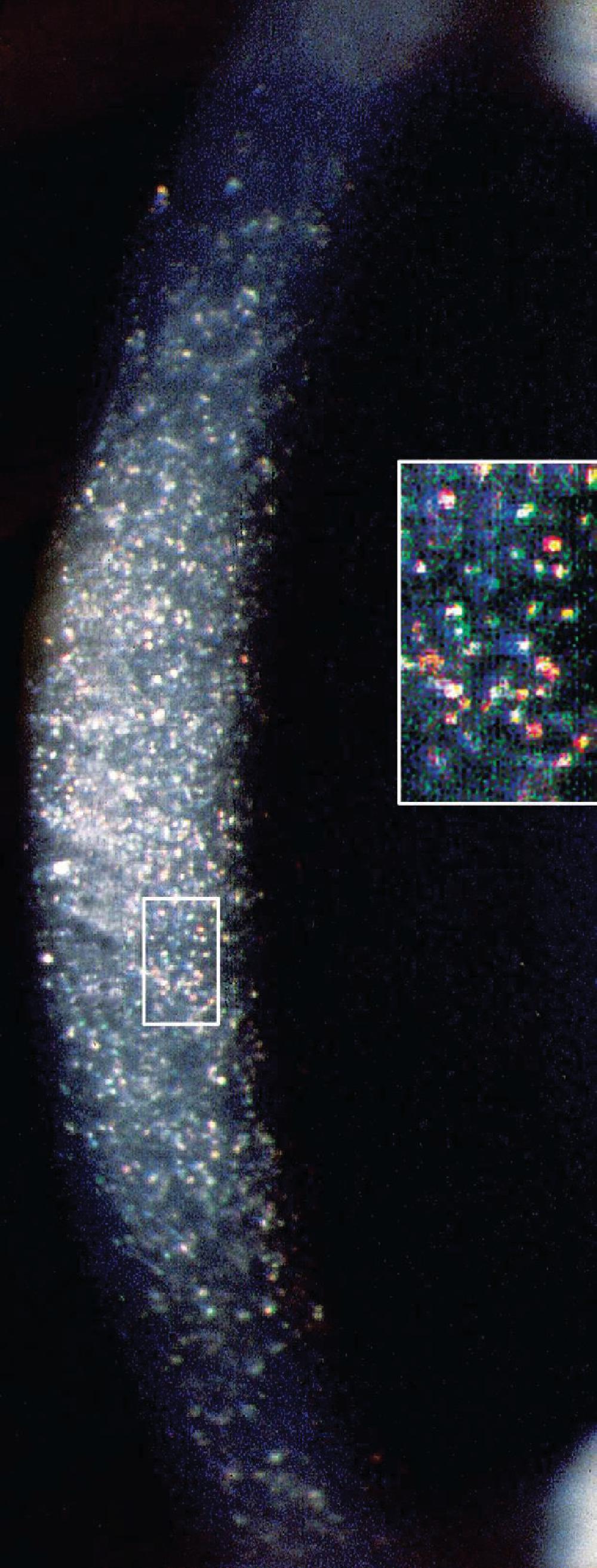 Fig. 64.4, Cystinosis .