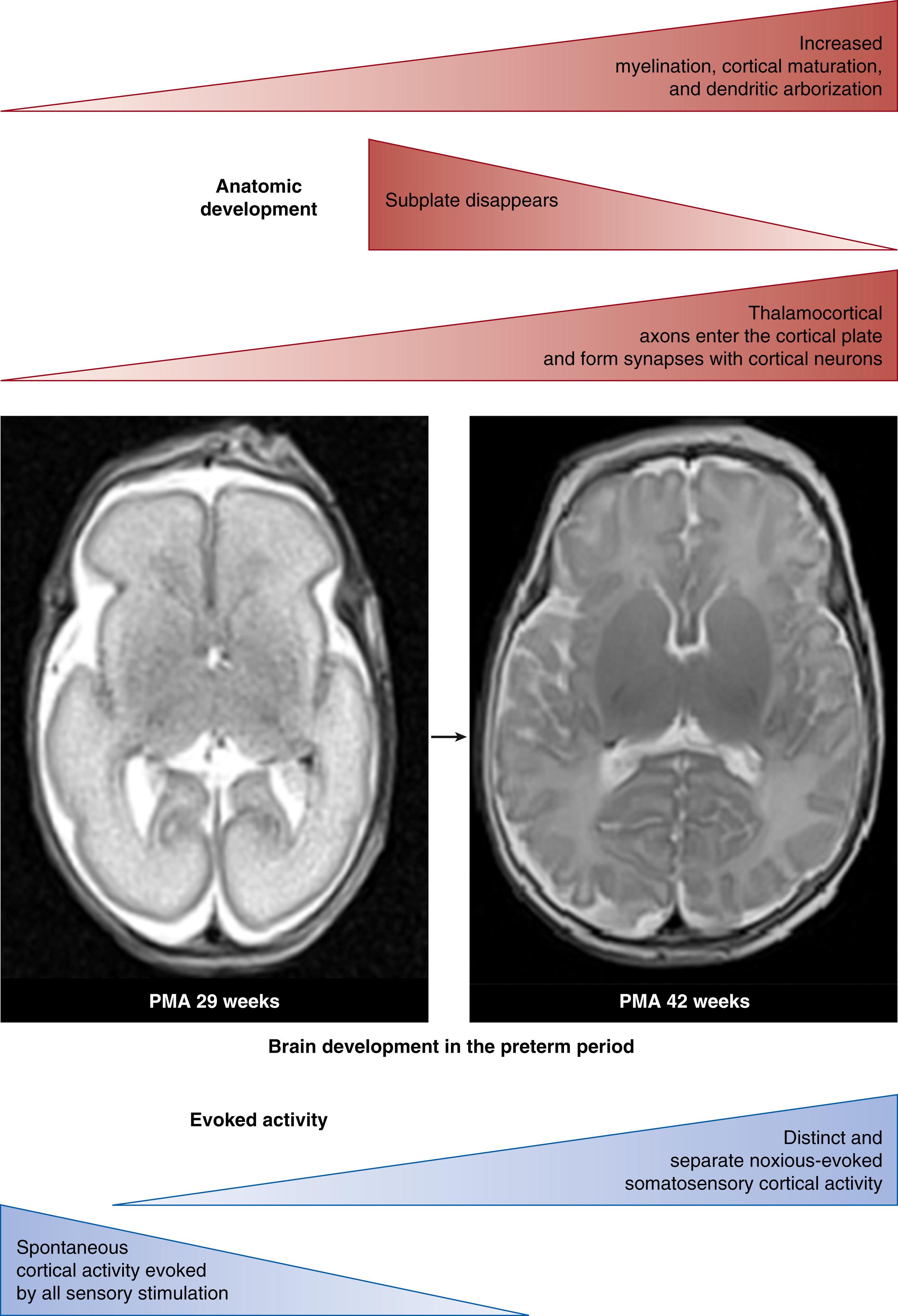 Fig. 128.1, Brain development in the preterm period. Changes in the anatomic development (red) and evoked cortical activity (blue) in the preterm period. Magnetic resonance imaging (MRI) shows the development of the brain from the preterm period (29 weeks; left ) to term (42 weeks; right ). See text for full details. PMA, Postmenstrual age.