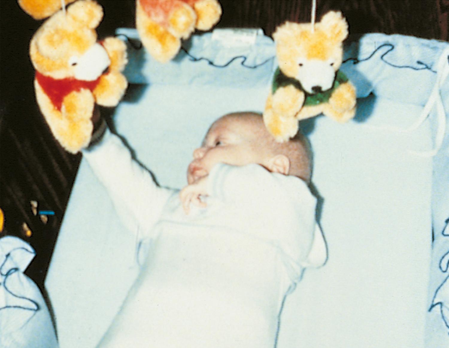 Fig. 3.14, Reaching and swiping. A 3-month-old infant uses his entire upper extremity as a unit in interacting with the toy.