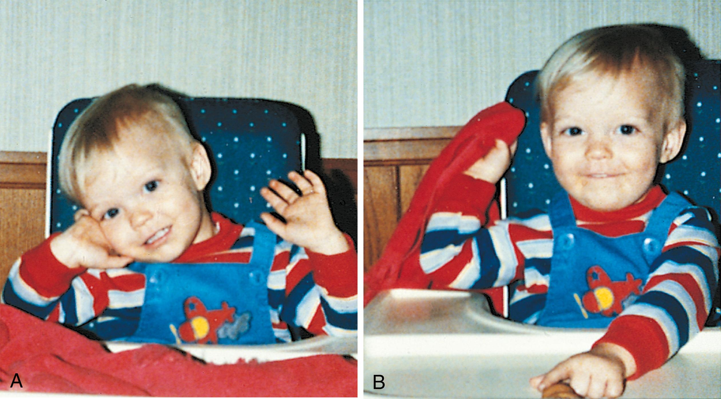 Fig. 3.24, Object permanence. (A and B) An 11-month-old child can locate a small, hidden object even if no part of it remains visible. In doing so, he is demonstrating his understanding that objects are permanent.